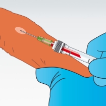 Multivette® 600 µl Li-Heparin gel grön /100